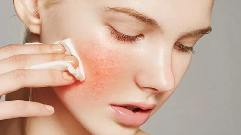 SLU-PP-332 Wound Healing And Skin Regeneration | Shaanxi BLOOM Tech Co., Ltd SLU-PP-332 Wound Healing And Skin Regeneration | Shaanxi BLOOM Tech Co., Ltd
